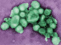 CDC:  At least 7 hospitalized with swine flu