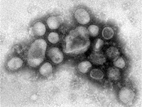 Swine flu resembles feared 1918 virus: study