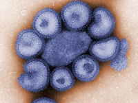 6 mysteries about the swine flu